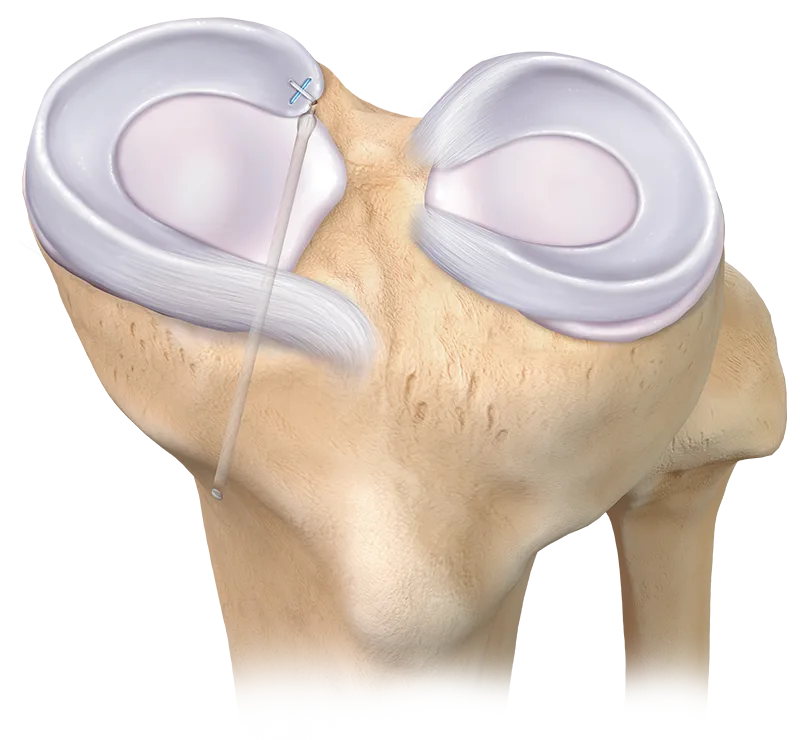 knee_ top knee specialist in portland